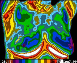 Thermal Scan