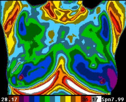 Thermal Scan