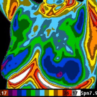 Thermal-scan